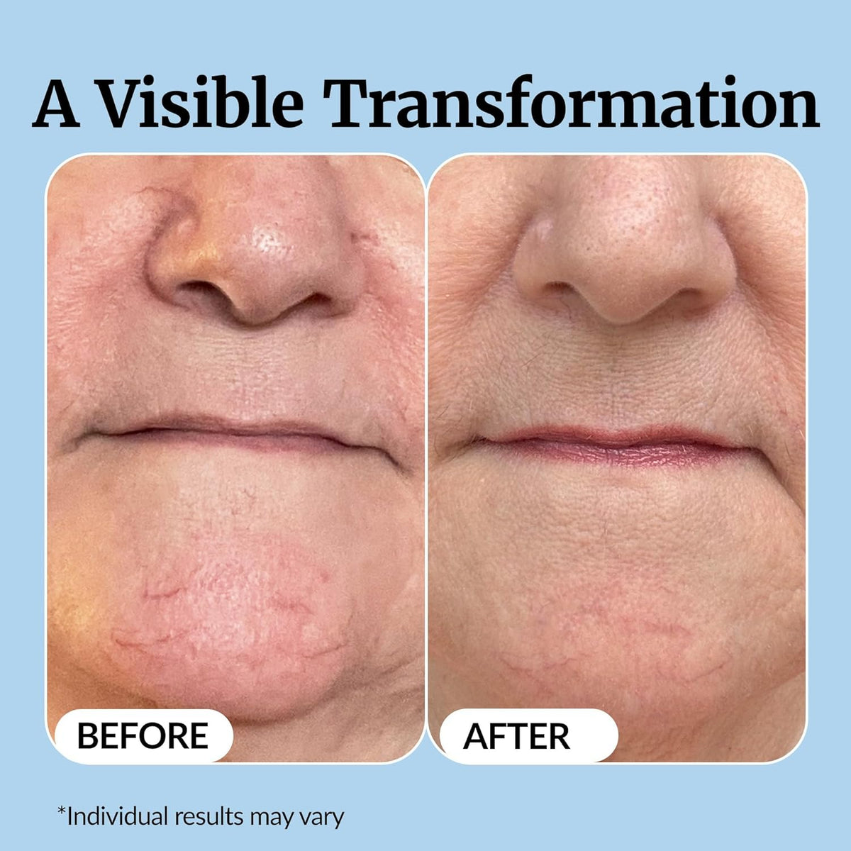 Vibriance Super C Vitamin C Serum for Mature Skin